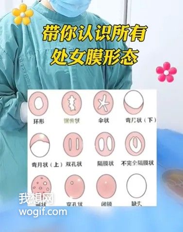 叫錯了30年，“處女膜”有了新名字：陰道瓣